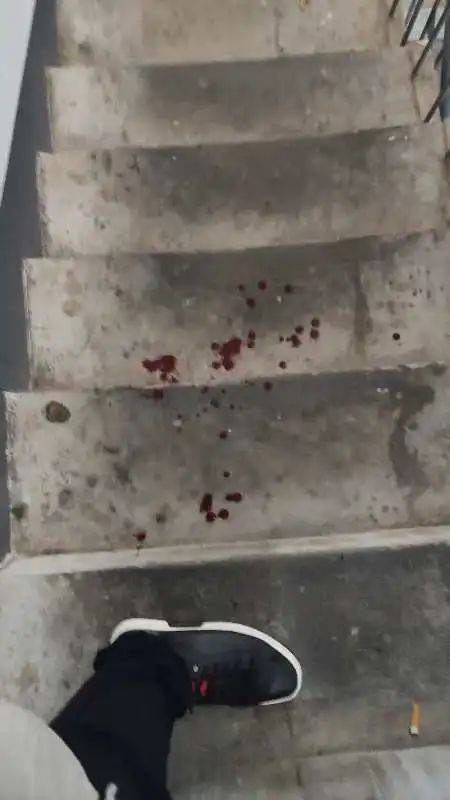 男子斥责遛狗不拴绳被打出血，次日送娃上学遭挑衅尾随，狗主人已被刑拘